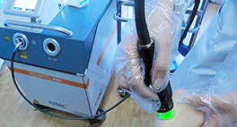 美国308nm准分子激光