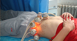 黑色素细胞种植